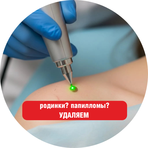 Slider Tolyatti udaleniya